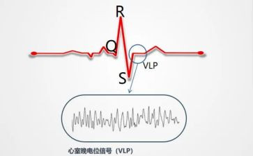 心电图科工作总结7篇